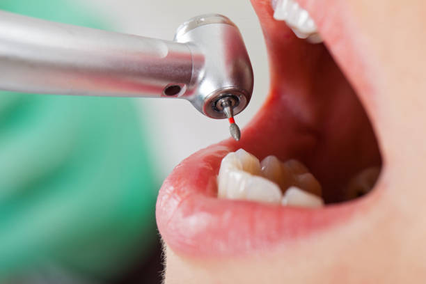 Best Emergency Treatment for Jaw Pain or Injury in Bainbridge Island, WA